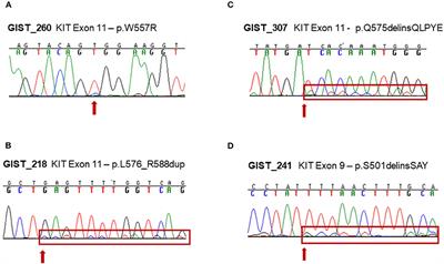 Frontiers | Targeted Deep Sequencing Uncovers Cryptic KIT Mutations In ...